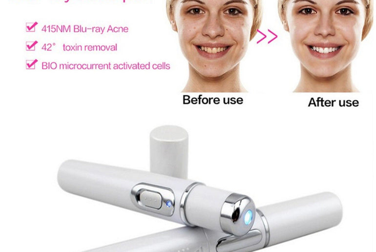 Blue Light Therapy Acne Laser - Urban Mart