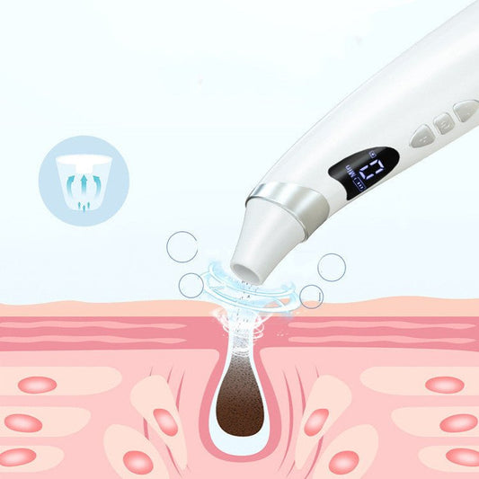 Electric Visual Blackhead Suction Instrument - Urban Mart