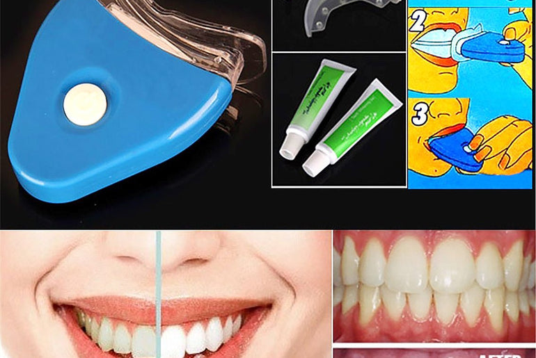 Oral Gel Teeth Tooth Whitening Whitener Dental Bleaching LED - Urban Mart